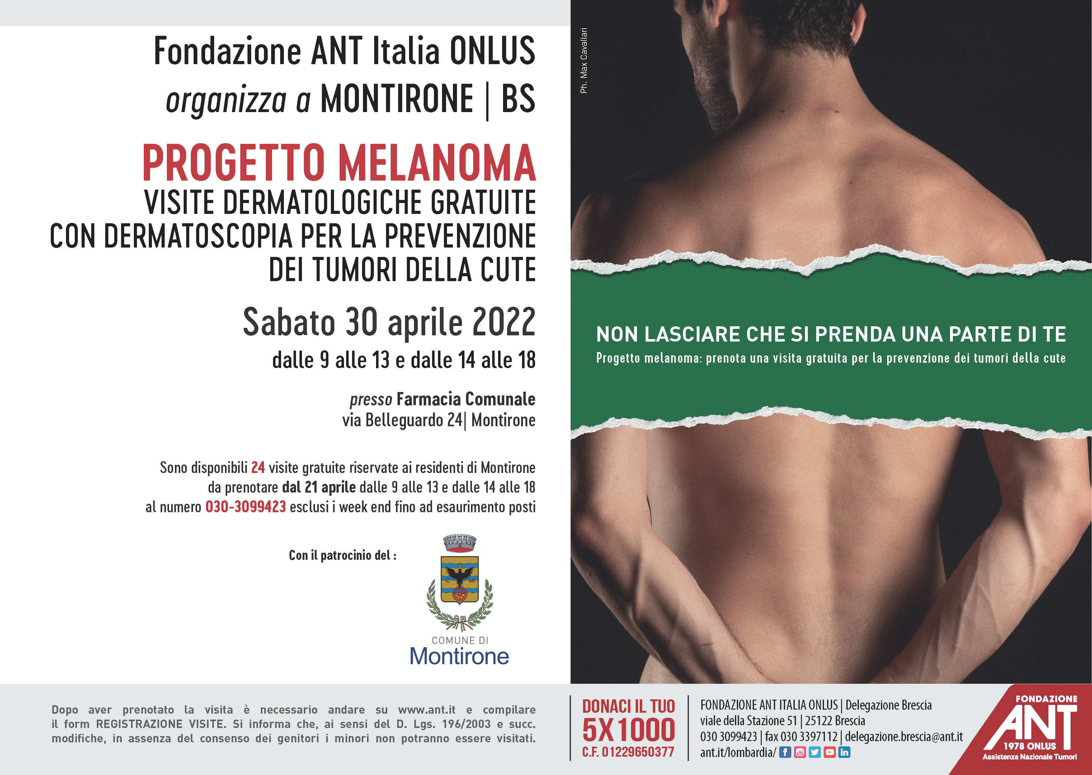 Immagine: Melanoma Montirone